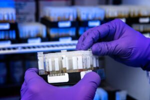 Exames laboratoriais de rotina: quais são os mais importantes e quando realizá-los?